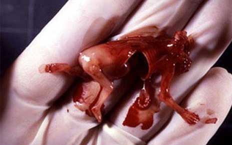  . Abortion photo